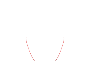 Red 1